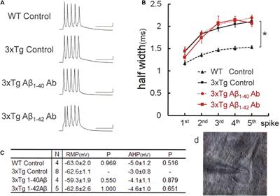 Amyloid β and Amyloid Precursor Protein Synergistically Suppress Large-Conductance Calcium-Activated Potassium Channel in Cortical Neurons